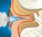 ProRinse Earwax Removal System Earplugs Mack's   